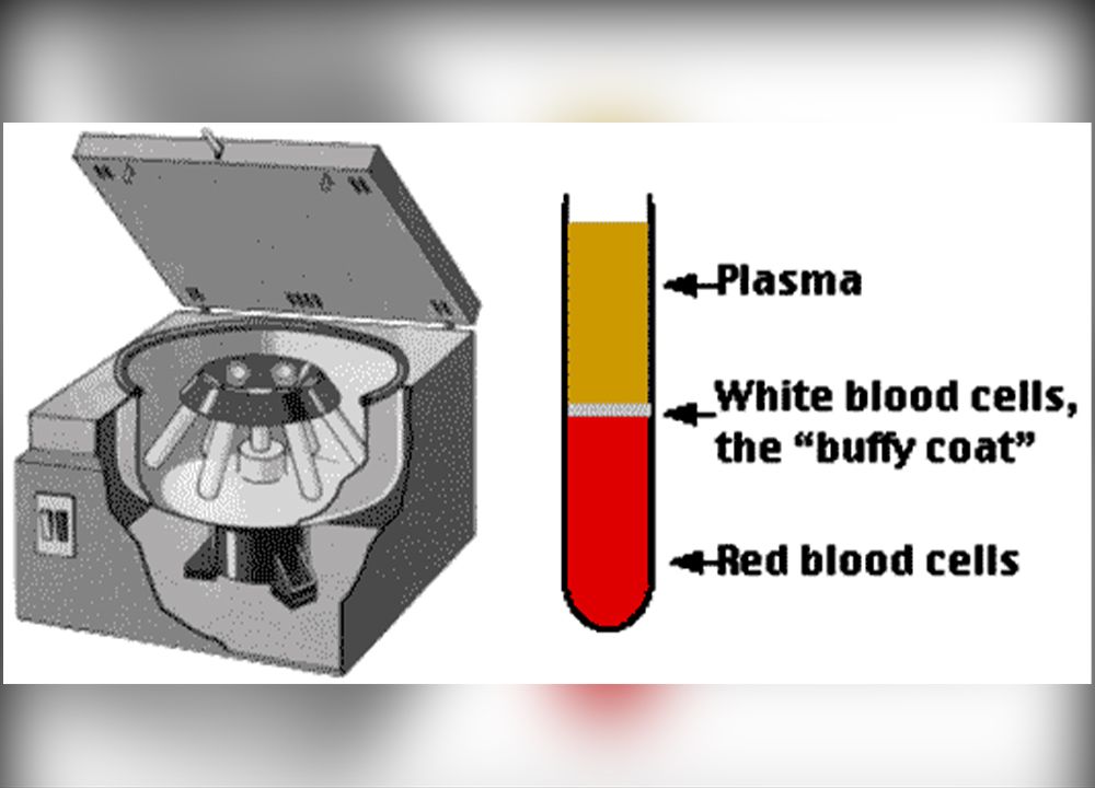 Step-By-Step PRP Therapy Process